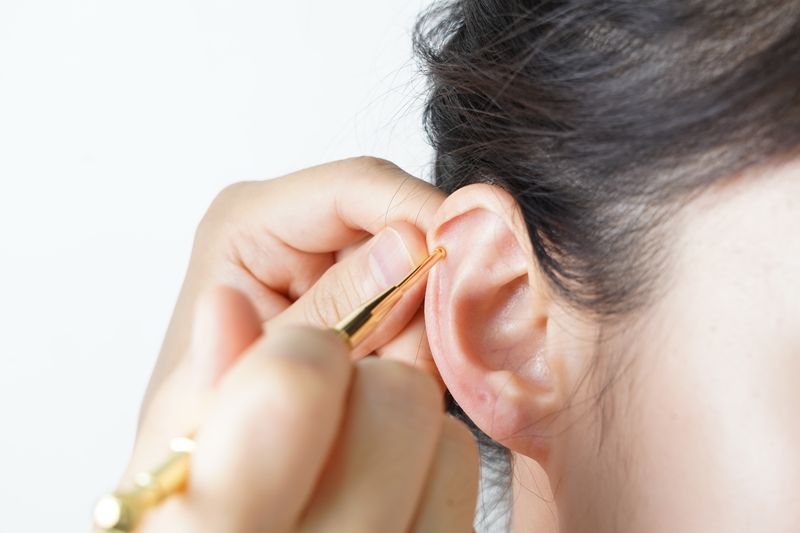 Estilete dorado aplicado en un punto de la oreja en auriculoterapia
